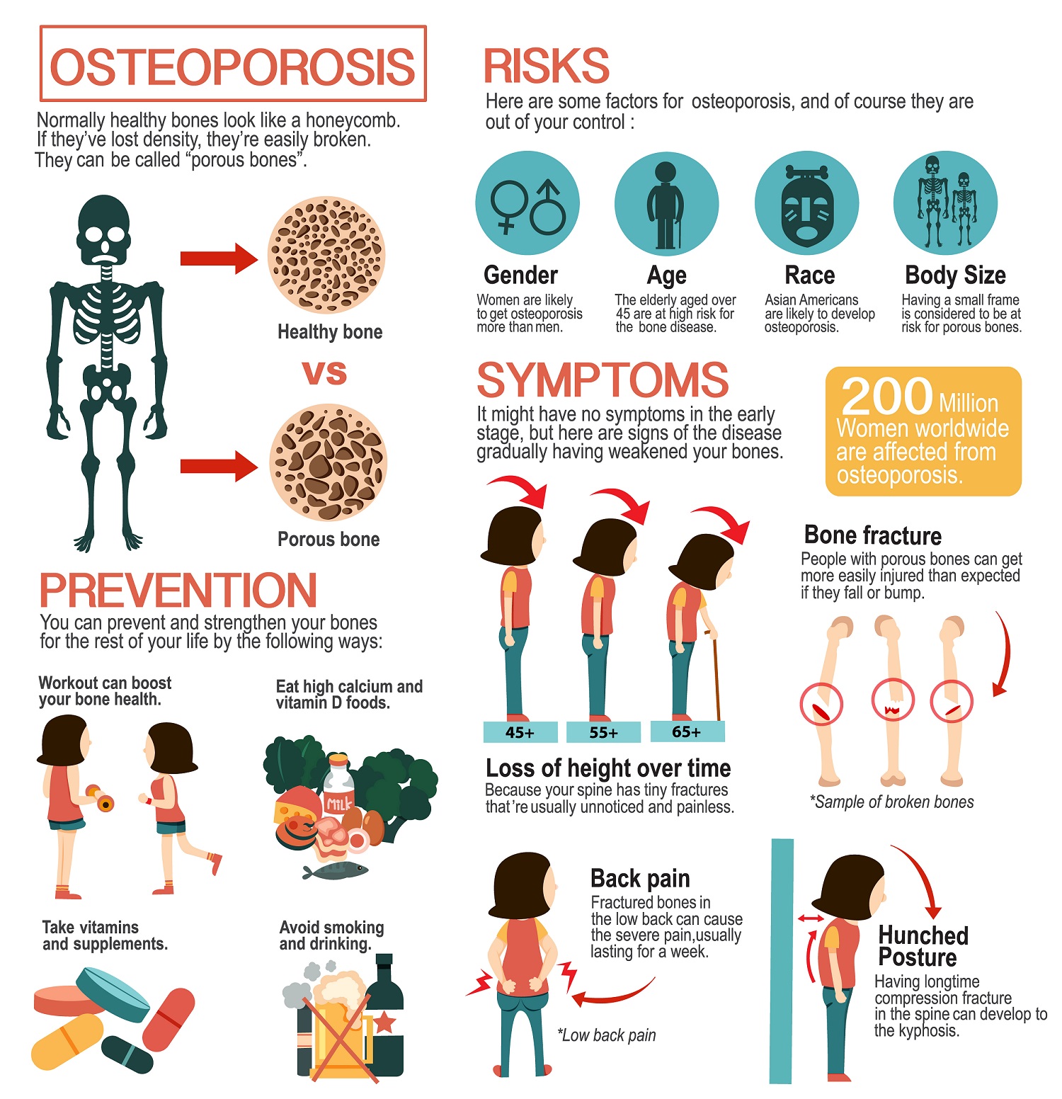 Osteoporosis: Symptoms, Causes and Treatment